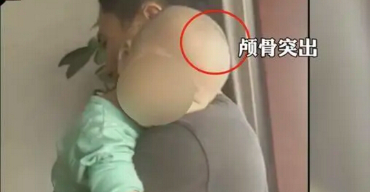 湖南“大頭娃娃”事件